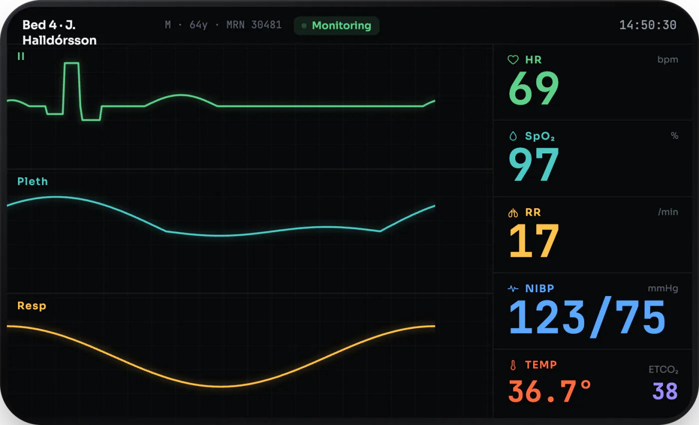 A GEA patient-monitor UI — live waveforms and vitals — rendered natively on an embedded MCU panel